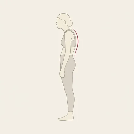 背中猫背（円背型）のイラスト。肩甲骨まわりが丸まり、背中の上部がカーブした横姿